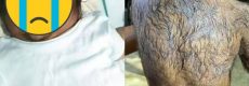 Ibu Muda Merana Bayinya Penuh Bulu Bak Manusia Serigala, Diduga Kena Kutukan Gegara Makan Kucing Saat Hamil, Dokter Ungkap Hal Ini