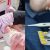 Kronologi Telapak Kaki Bayi di Medan Melepuh Usai Lakukan Skrining